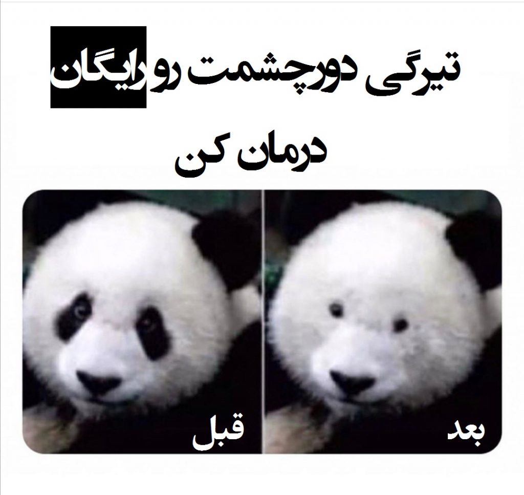 تیرگی دورچشم